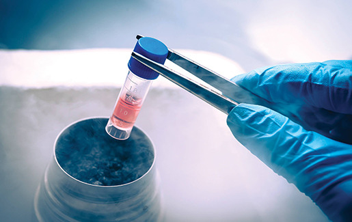 All about FET (FROZEN EMBRYO TRANSFER)